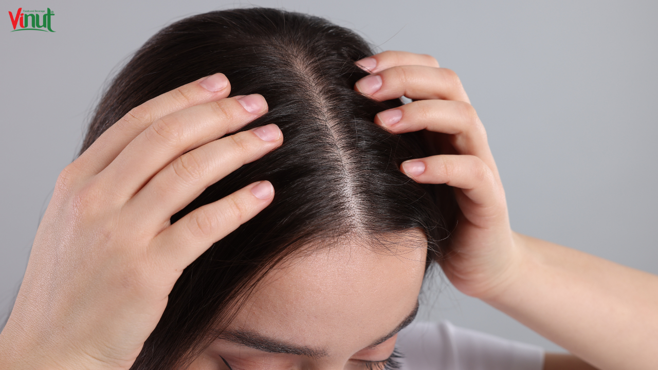 VINUT_ Boosts Scalp Health