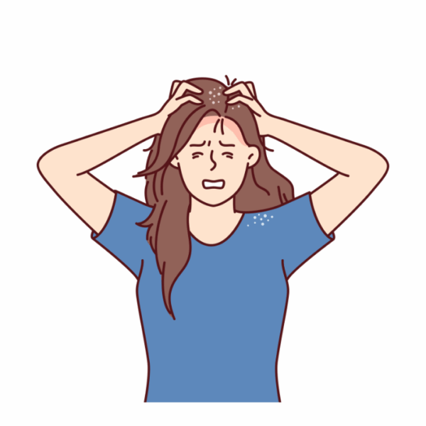 VINUT_Prevents Dandruff and Dry Scalp