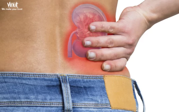 VINUT_May help prevent kidney stones VINUT_May help prevent kidney stones